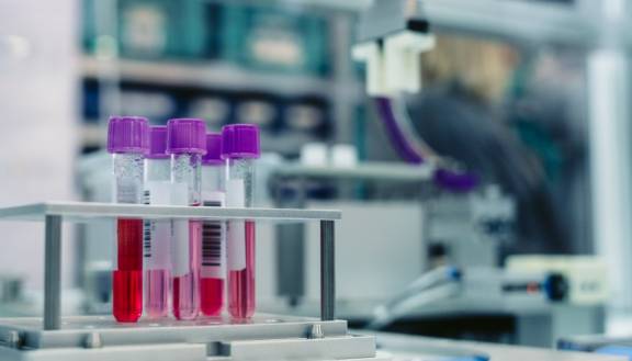 analytica 2026 in München